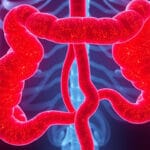 Enteritis Ursachen, Symptome und effektive Behandlungsmethoden verstehen